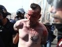 An injured England fan is arrested after clashes ahead of the game against Russia on June 11, 2016
